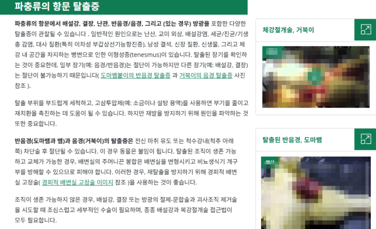 배설강탈출증 의료 정보 인포그래픽